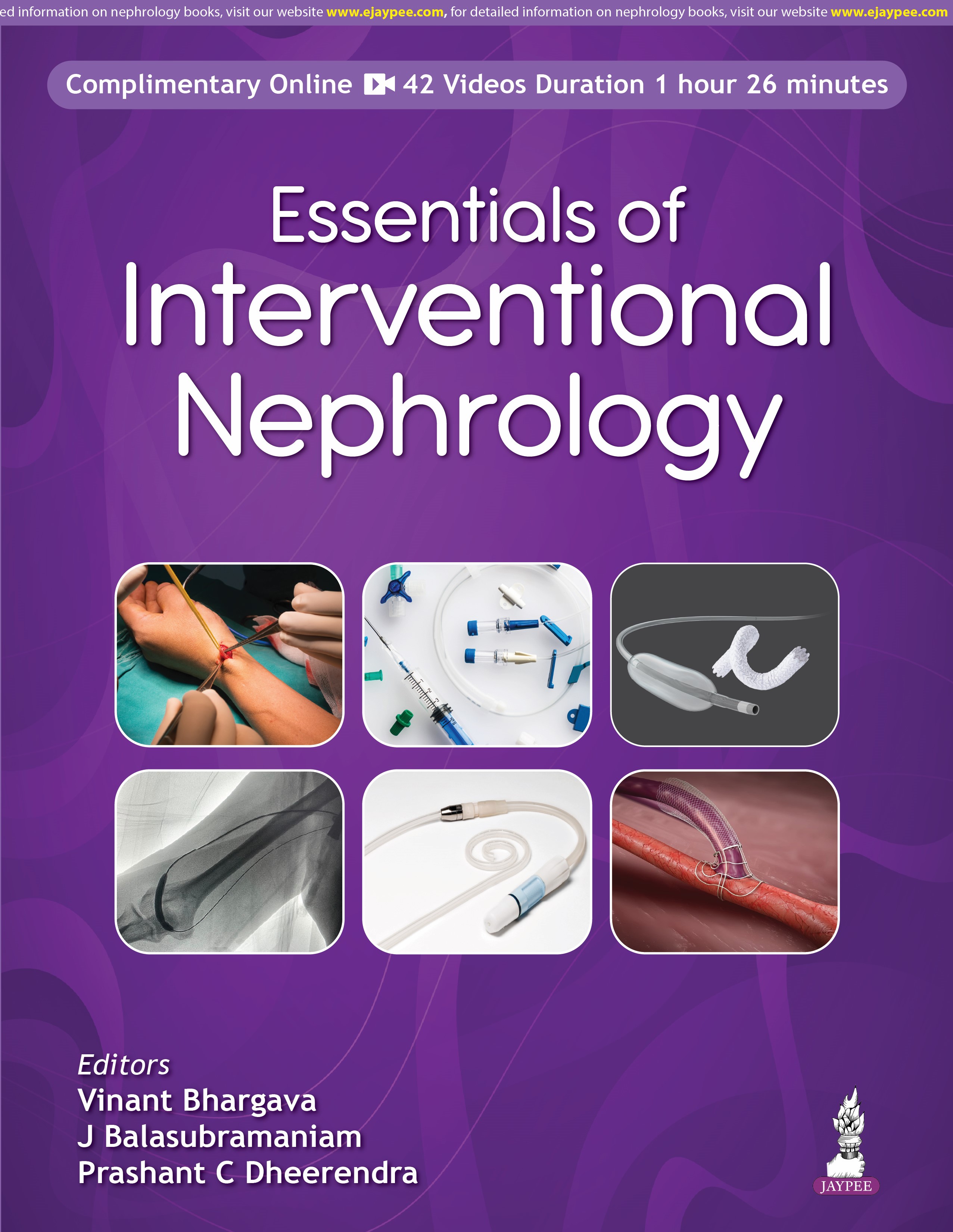 Essentials of Interventional Nephrology 1st/2026